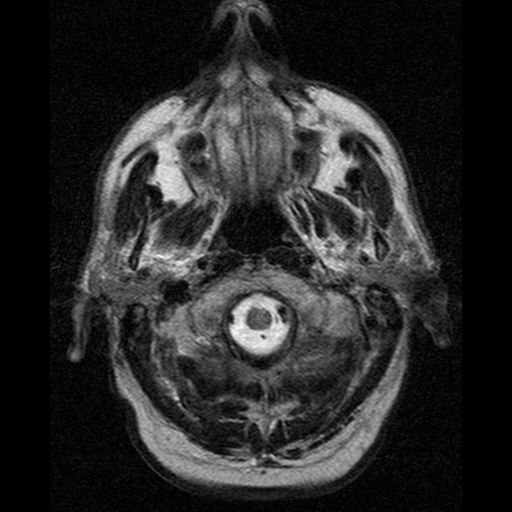 Gif of MRI scan